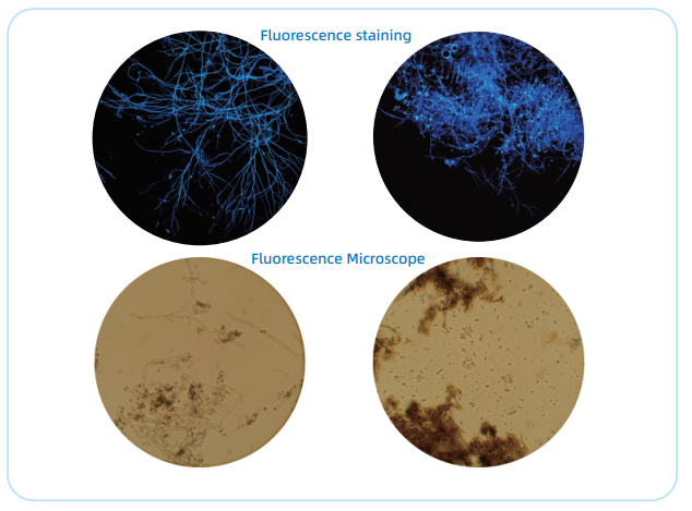 真菌及荧光染色液3.png 真菌及荧光染色液3.png